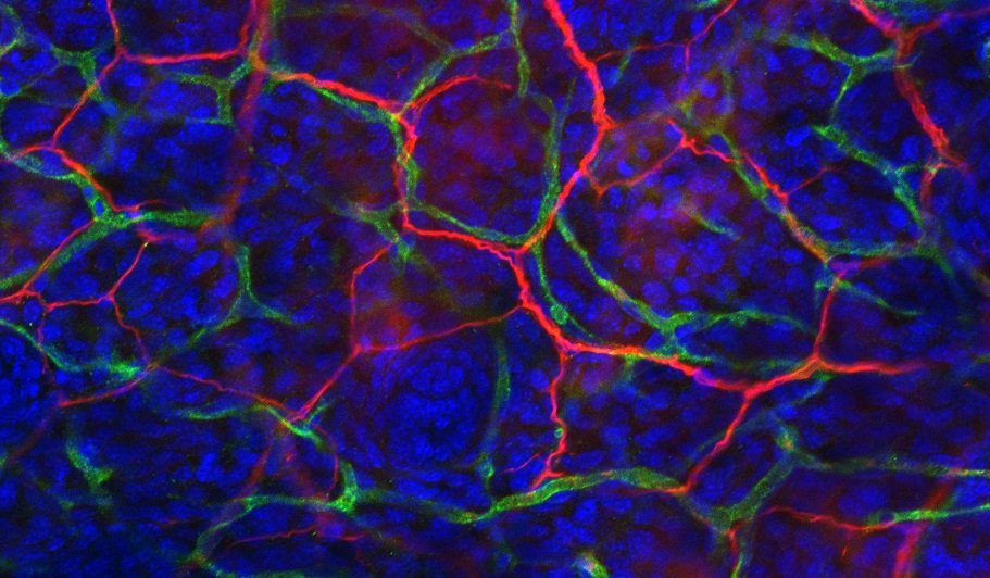 neurovascular parallel arignment