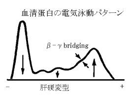 急変 肝硬変