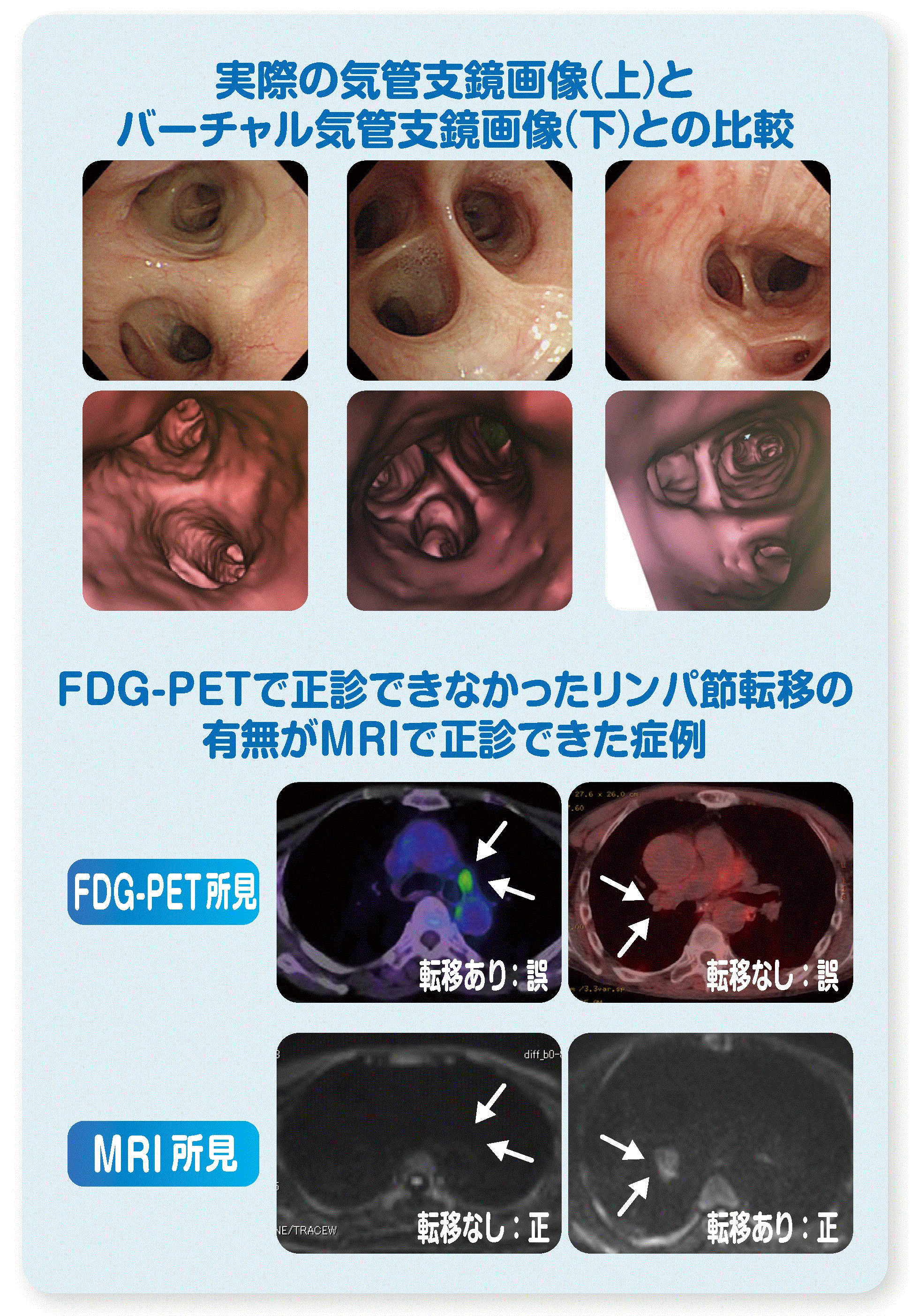 器官支鏡画像.gif