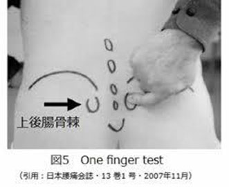 仙腸関節障害｜金沢医科大学 整形外科学