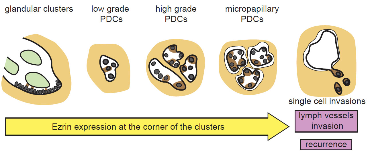 PDC_progression_Model”　width=