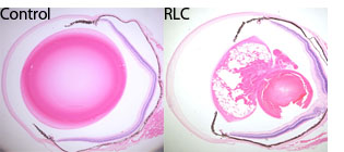 RLCマウスのHE標本”width=